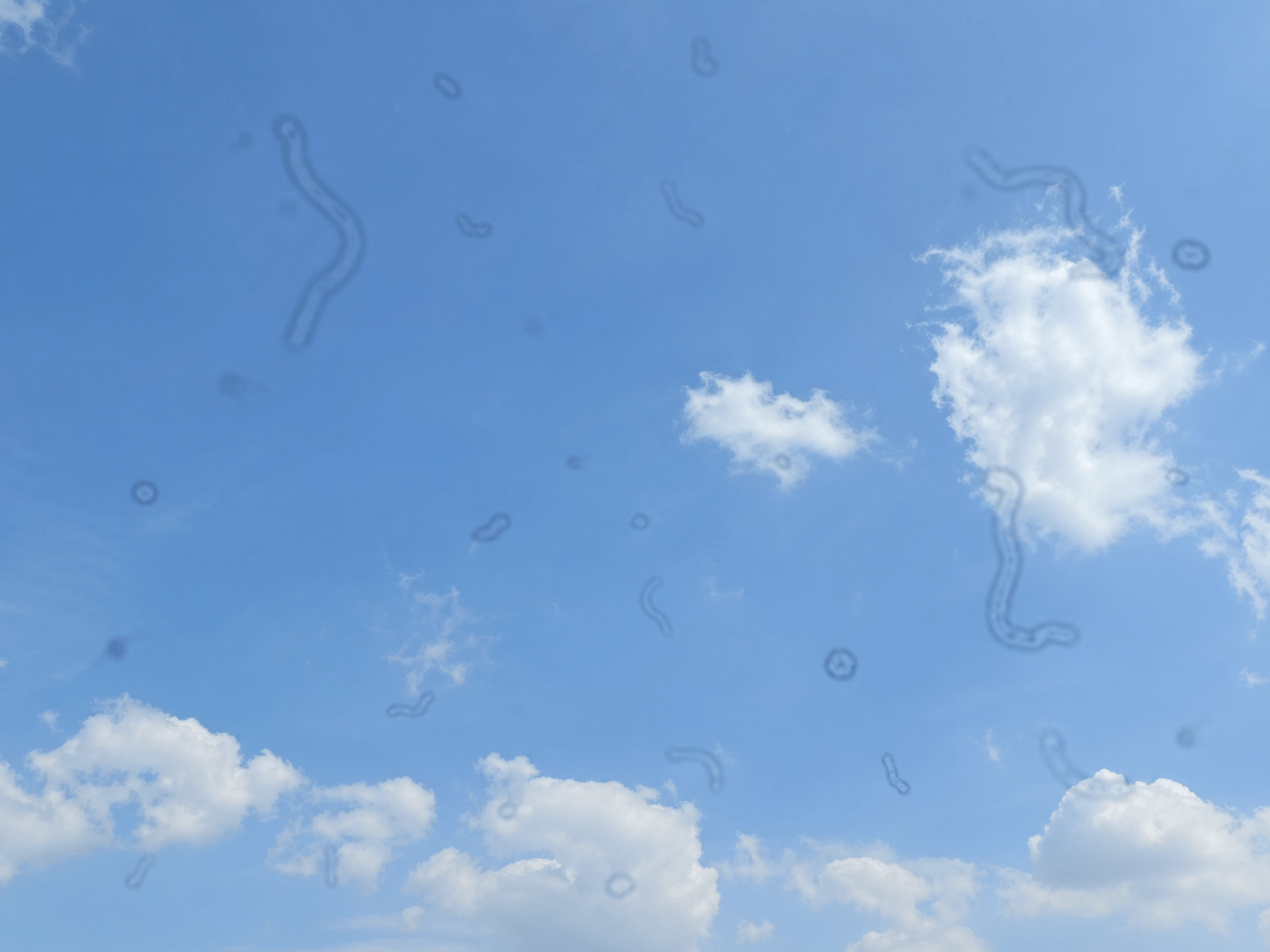 Eye floaters seen against a bright background